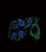 CYP2S1 Antibody in Immunocytochemistry (ICC/IF)