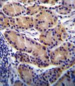 CYP2S1 Antibody in Immunohistochemistry (Paraffin) (IHC (P))