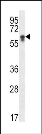 CYP2S1 Antibody in Western Blot (WB)