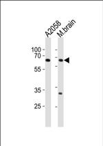 LZTS1 Antibody in Western Blot (WB)