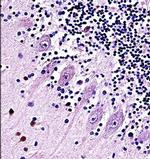 TRPC5 Antibody in Immunohistochemistry (Paraffin) (IHC (P))