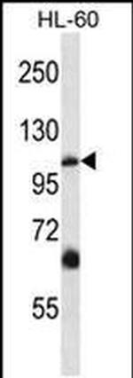 TRPC5 Antibody in Western Blot (WB)