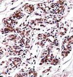 UBP1 Antibody in Immunohistochemistry (Paraffin) (IHC (P))