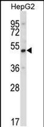UBP1 Antibody in Western Blot (WB)