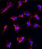 NANOS1 Antibody in Immunocytochemistry (ICC/IF)