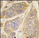 NANOS1 Antibody in Immunohistochemistry (Paraffin) (IHC (P))