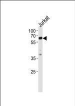 Zap-70 Antibody in Western Blot (WB)