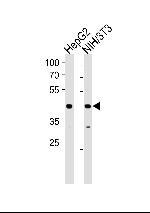 NR2F2 Polyclonal Antibody