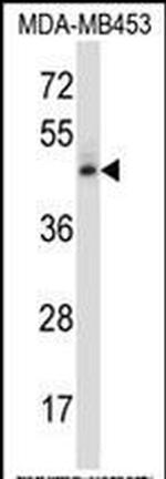 NR2F1 Antibody in Western Blot (WB)