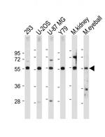 FOXD1 Antibody in Western Blot (WB)