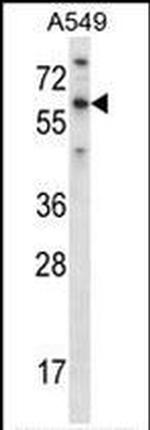 T-bet Antibody in Western Blot (WB)