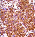 IRX3 Antibody in Immunohistochemistry (Paraffin) (IHC (P))