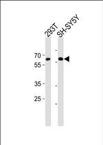 IRX3 Antibody in Western Blot (WB)