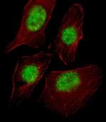 TAF9 Antibody in Immunocytochemistry (ICC/IF)