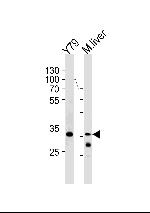 ZONAB Polyclonal Antibody