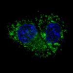 ALDH1A1 Antibody in Immunocytochemistry (ICC/IF)
