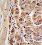 ALDH1A1 Antibody in Immunohistochemistry (Paraffin) (IHC (P))