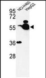 ALDH1A1 Antibody in Western Blot (WB)