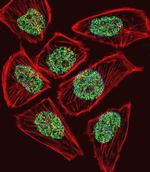 TADA3L Antibody in Immunocytochemistry (ICC/IF)