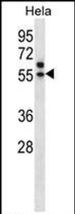TADA3L Antibody in Western Blot (WB)