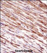 HSPBP1 Polyclonal Antibody