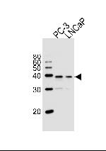 VDR Polyclonal Antibody
