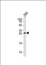 TGIF2 Antibody in Western Blot (WB)