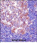 PU.1 Antibody in Immunohistochemistry (Paraffin) (IHC (P))