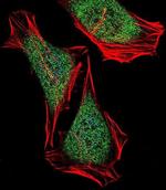 ECSIT Antibody in Immunocytochemistry (ICC/IF)