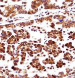 ORC3 Antibody in Immunohistochemistry (Paraffin) (IHC (P))