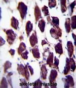 POLG Antibody in Immunohistochemistry (Paraffin) (IHC (P))