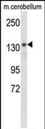 POLG Antibody in Western Blot (WB)