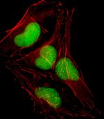 SOX18 Antibody in Immunocytochemistry (ICC/IF)