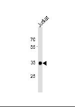 SOX18 Antibody in Western Blot (WB)