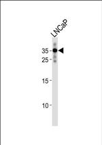 RNF4 Antibody in Western Blot (WB)