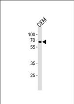 ZNF90 Antibody in Western Blot (WB)