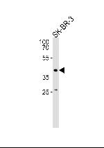 ELK3 Polyclonal Antibody