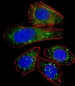ZNF81 Antibody in Immunocytochemistry (ICC/IF)