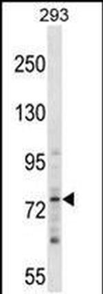ZNF81 Antibody in Western Blot (WB)