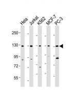 RFX1 Antibody in Western Blot (WB)