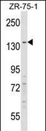 RFX1 Antibody in Western Blot (WB)