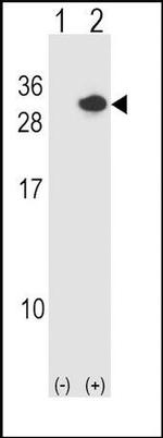 RCAN1 Antibody in Western Blot (WB)