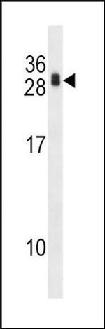 RCAN1 Antibody in Western Blot (WB)