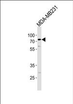 TRIM25 Antibody in Western Blot (WB)