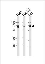 AMPK gamma-3 Antibody in Western Blot (WB)