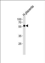 ZNF71 Antibody in Western Blot (WB)