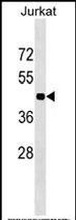 HOXC10 Antibody in Western Blot (WB)