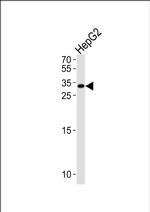 Nkx6.3 Antibody in Western Blot (WB)