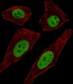 TFAP2D Antibody in Immunocytochemistry (ICC/IF)