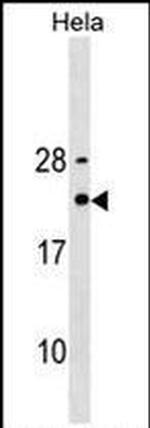 TPT1 Antibody in Western Blot (WB)